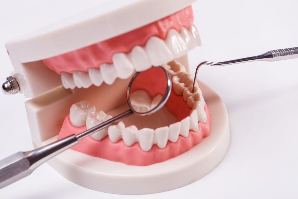 gum trimming gingivectomy and gingivoplasty