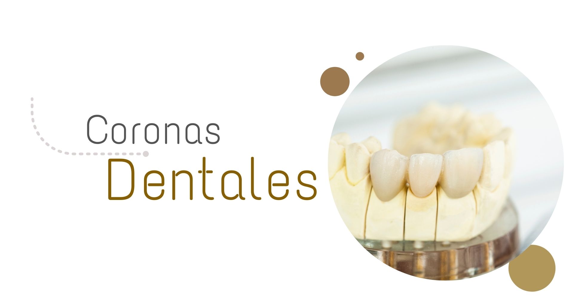 Coronas dentales en Medellín