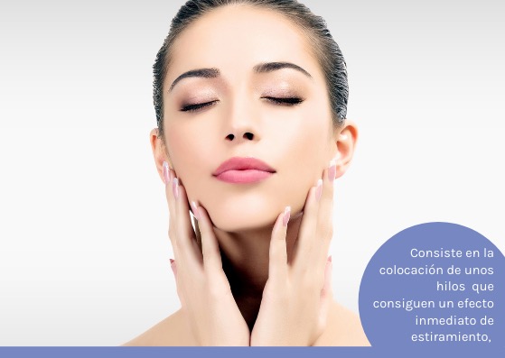 lifting facial consiste en la colocación de hilos