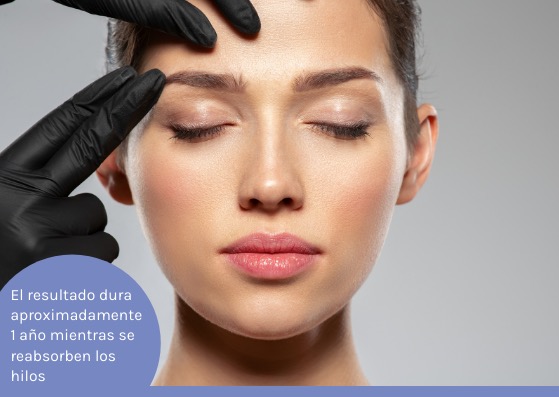 el lifting facial dura un año