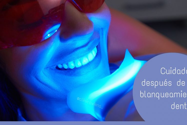 cuidado dientes despues de blanqueamiento, 10 ways to take care of your teeth whitening, Having a white, bright smile can make a huge difference in how we feel about ourselves