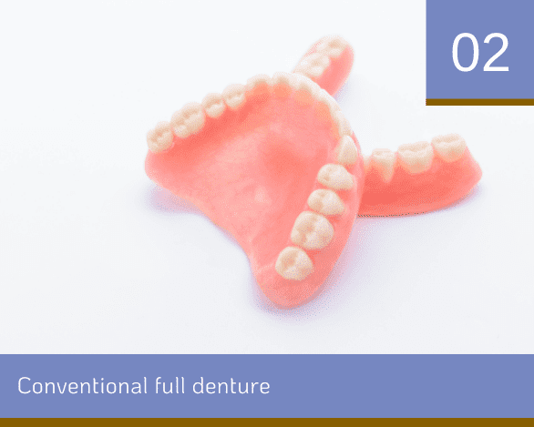 conventional full denture