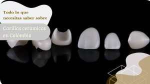 Carillas ceramicas en Colombia