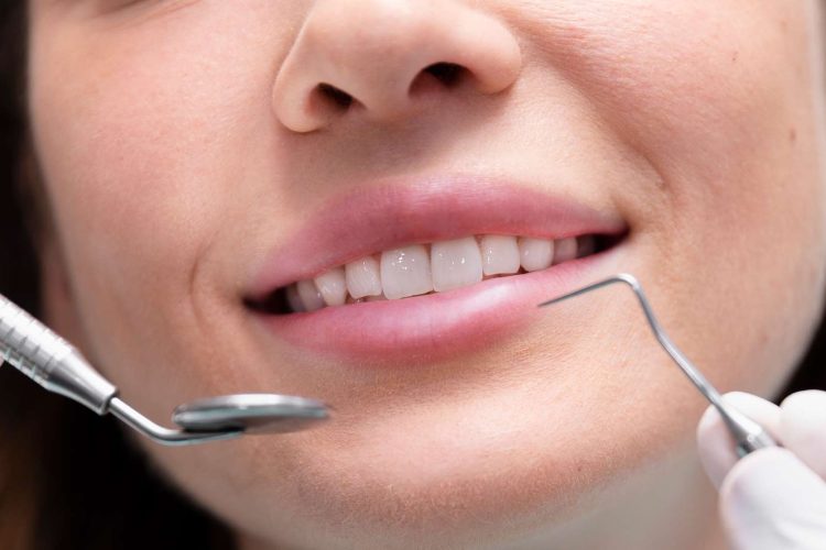 Close-up of a patient’s smile during a dental check-up with dental tools in view