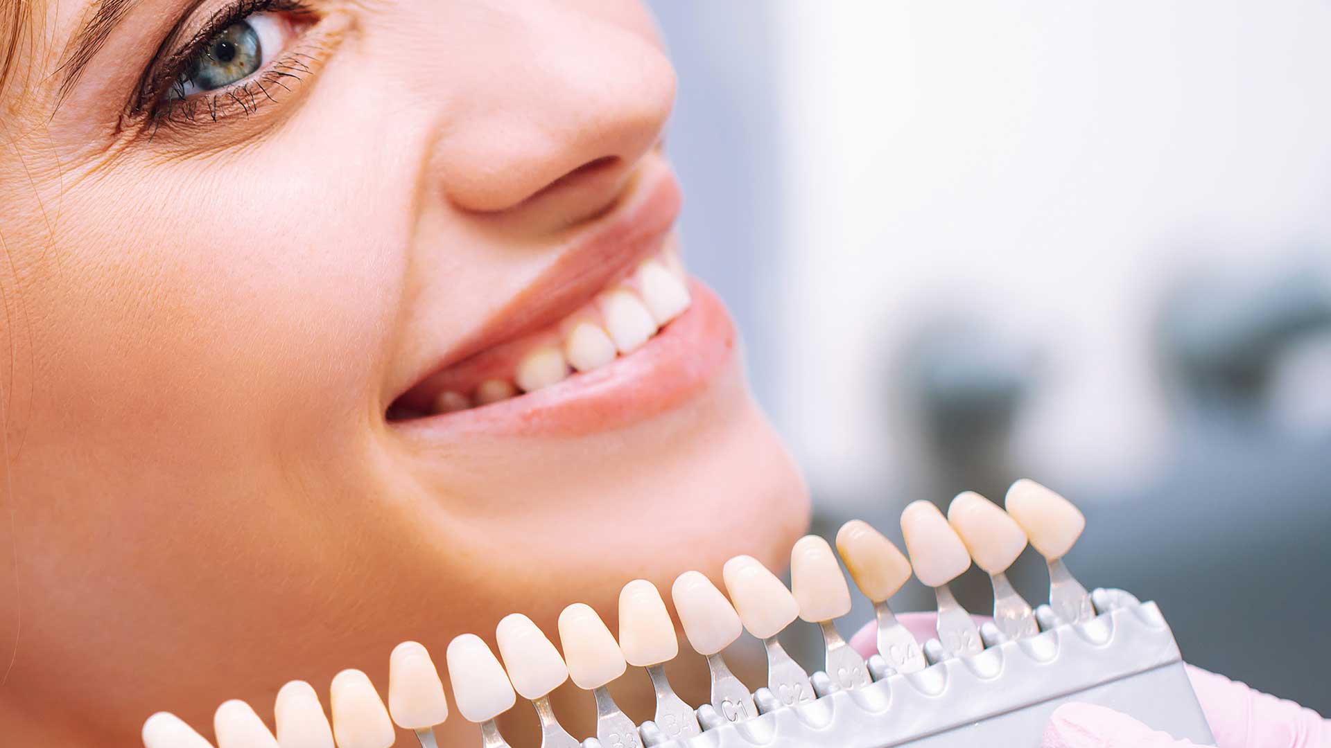 Smiling woman in a dental chair with a shade guide for dental veneers