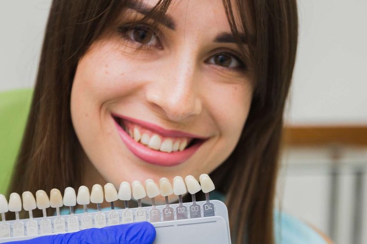 Woman smiling and holding dental veneer samples in her hand, Veneer cost, dental veneers, porcelain veneers, composite veneers, smile enhancement, dental treatment, cosmetic dentistry, tooth color matching, dental clinic, veneers in Colombia