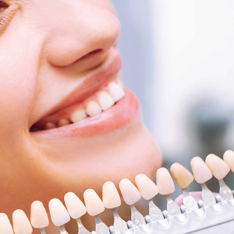 Why Choose Colombia for Dental Work? Explore Your Options