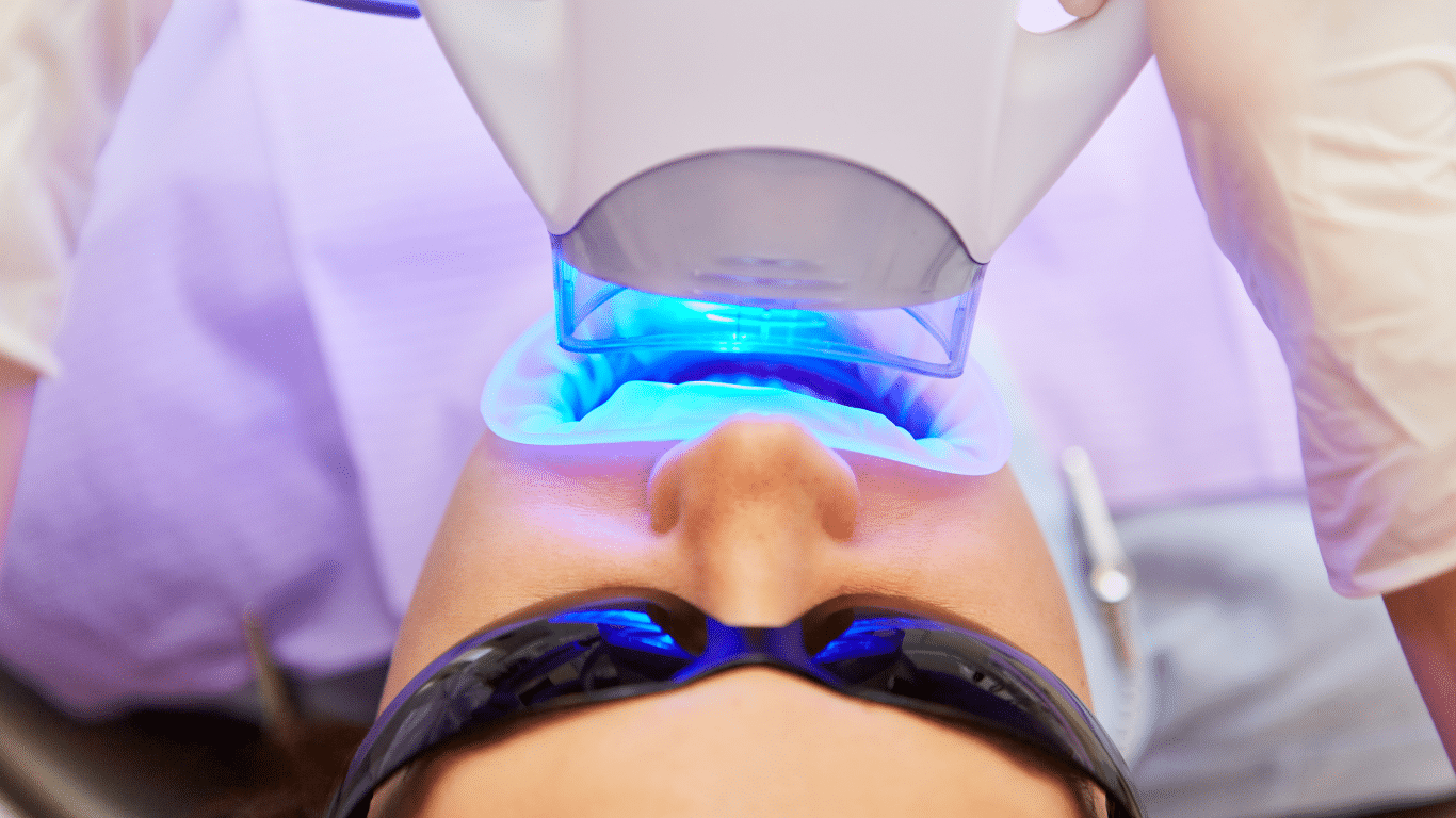 Blanqueamiento Dental Led Blanqueamiento dental led