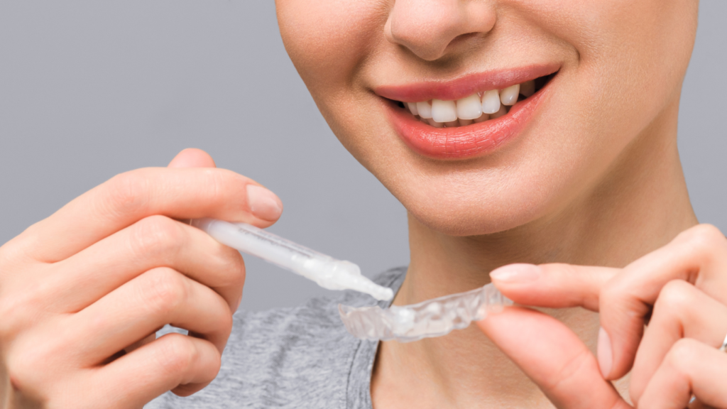 Botox Para Bruxismo: ¿Cómo Funciona Y Cuándo Se Recomienda? Blanqueamiento dental