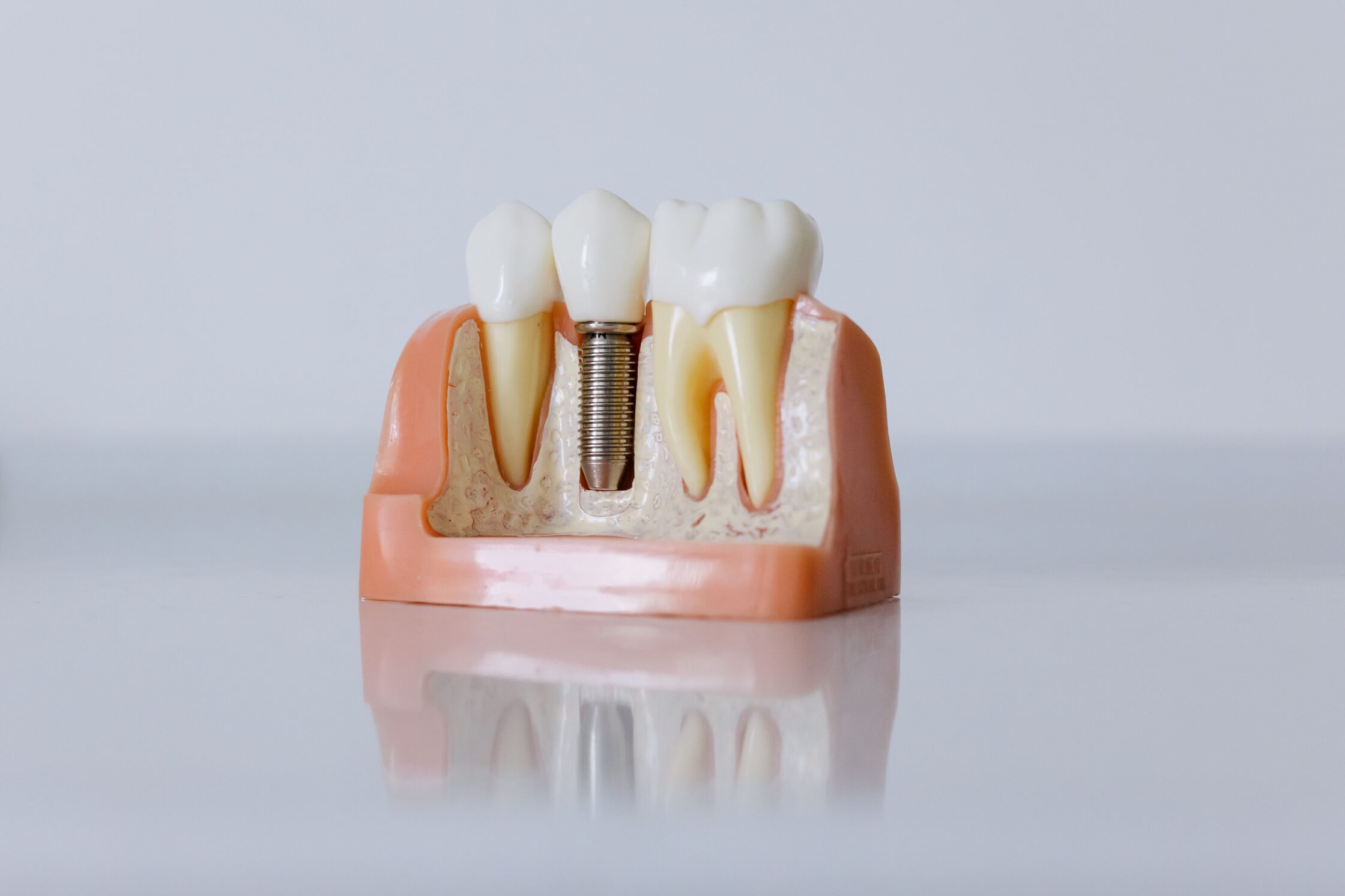 How to relieve pain from dental implants