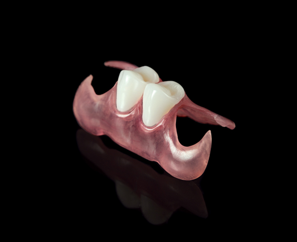 flexible denture